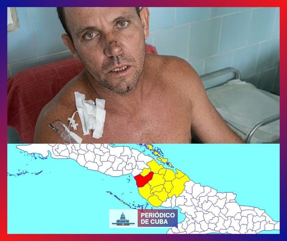 Hombre resulta gravemente herido tras violenta agresión en Florida, Camagüey