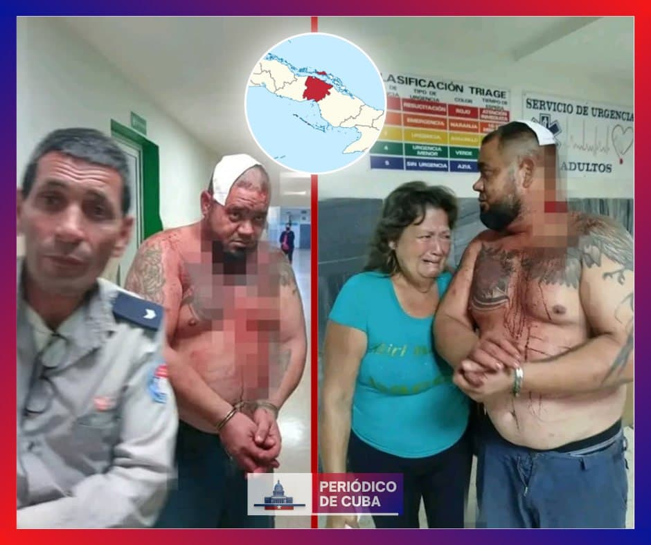Denuncian brutal agresión policial a un hombre en Ciego de Ávila tras protestar por apagones