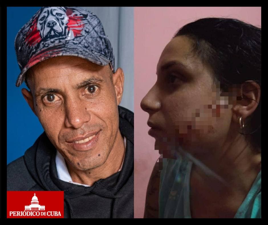 Intento de feminicidio en Camagüey: agresor prófugo