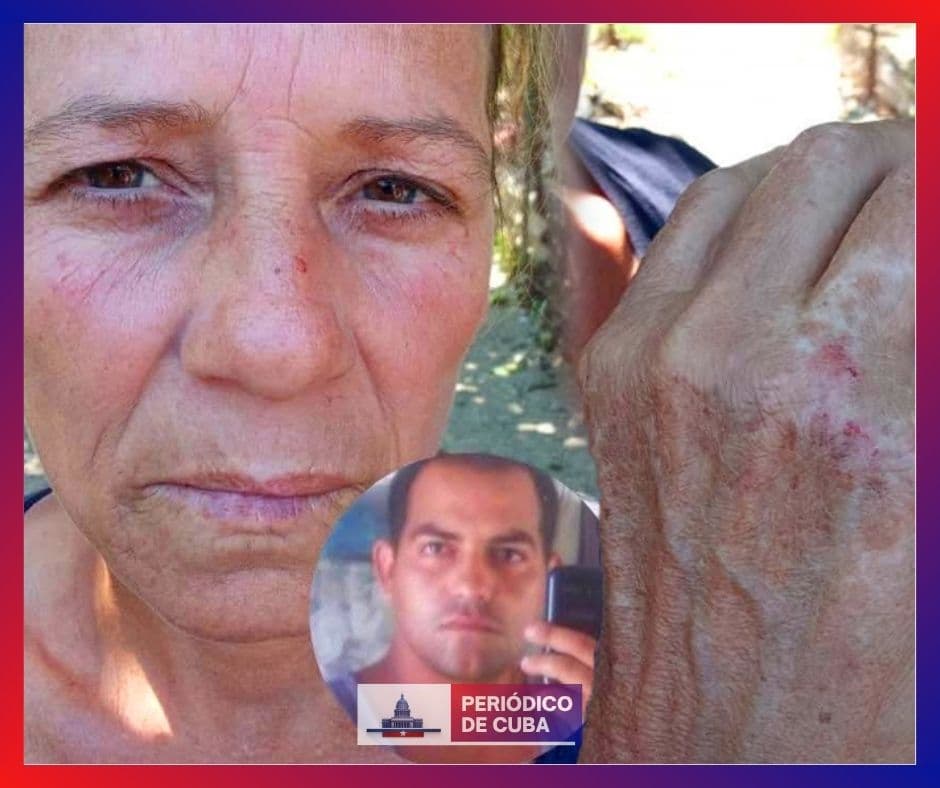 Madre de manifestante en Las Minas denuncia represión tras arresto violento