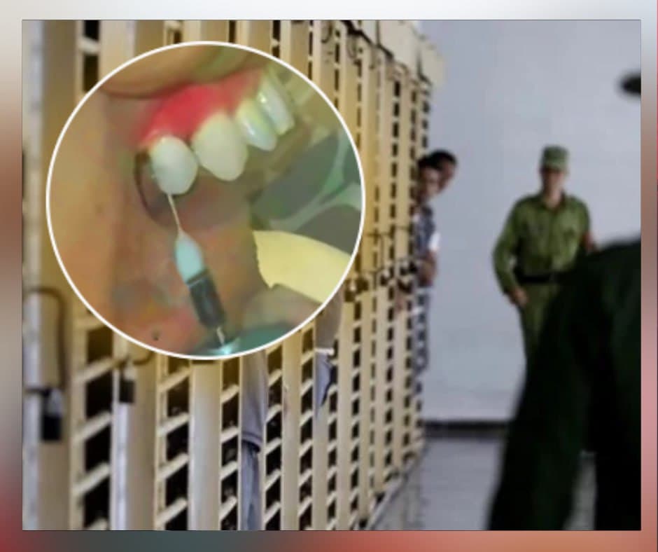 Presos en Cuba fabrican turbina dental artesanal