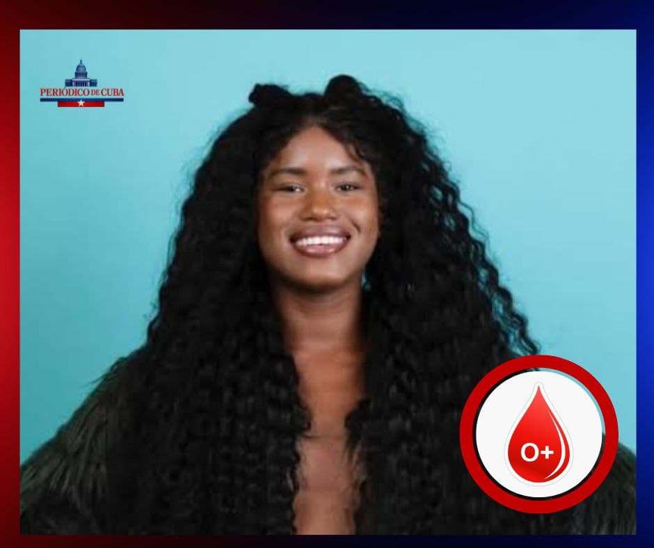 Influencer cubana Yurisleydis Mora “RiRi” en estado crítico tras sufrir quemaduras graves