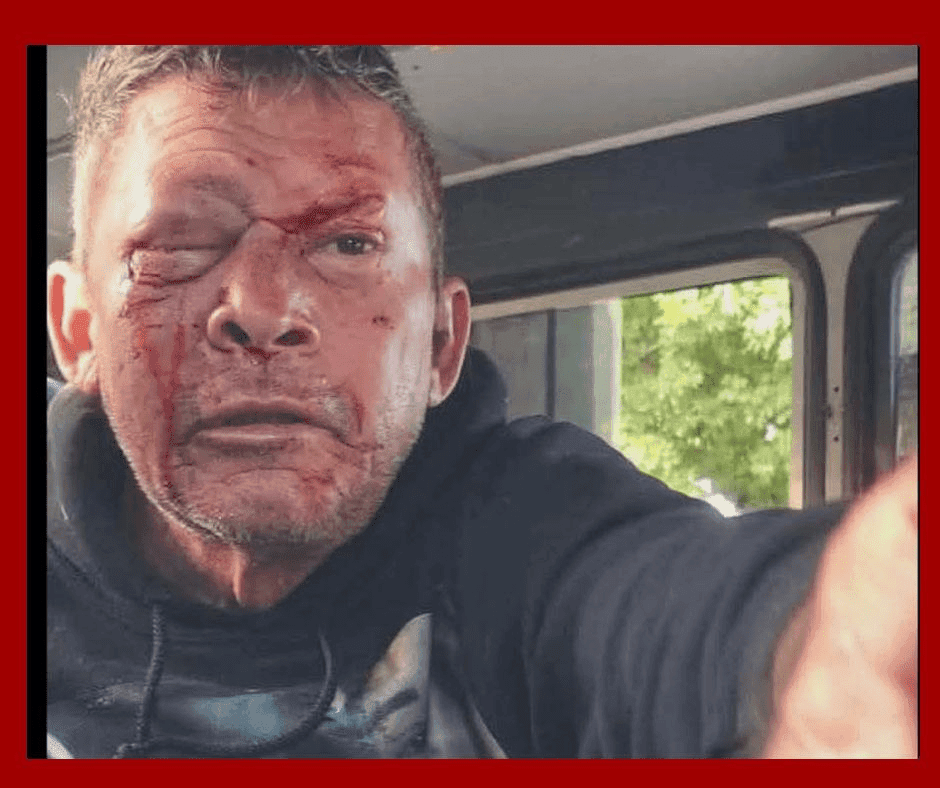 Violencia en Chaparra: hombre brutalmente agredido mientras la PNR no actúa