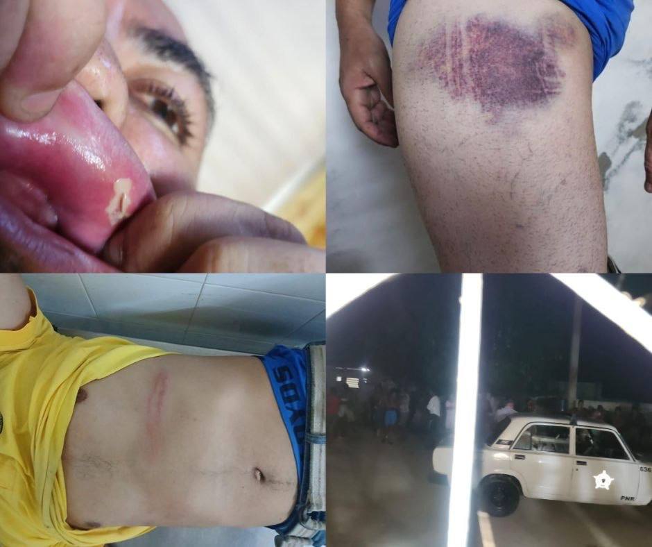 Acto de repudio contra periodista liberado en Caimanera