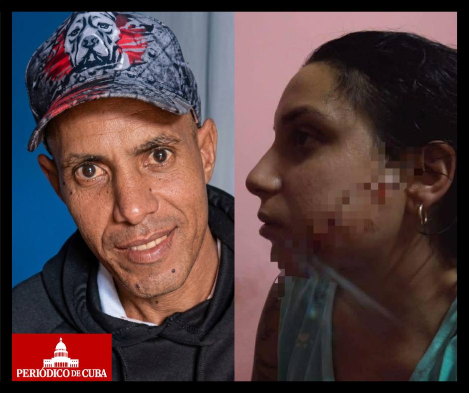 Intento de feminicidio en Camagüey: agresor prófugo