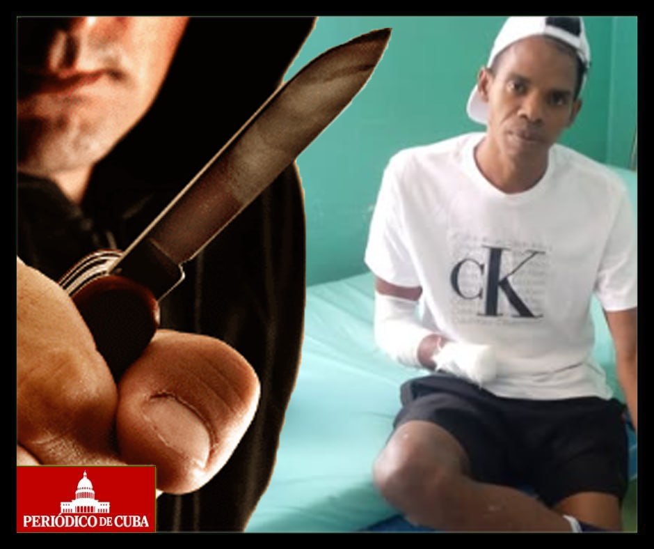 Joven pierde mano por robo en La Habana: heroísmo y dolor