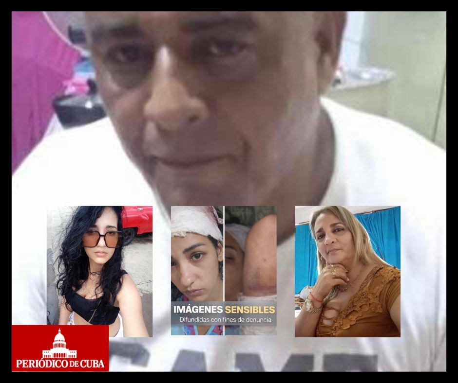 Agresor prófugo apuñala a tres personas en Bayamo: comunidad exige acción inmediata