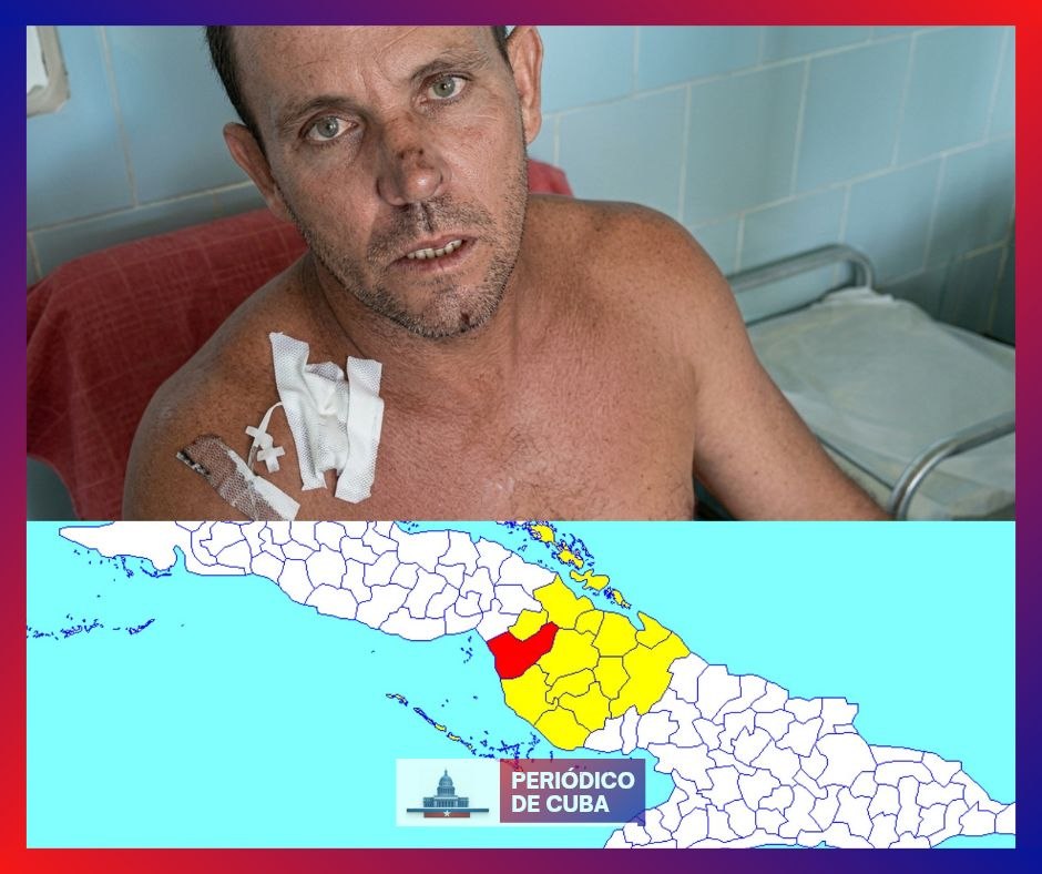 Hombre resulta gravemente herido tras violenta agresión en Florida, Camagüey