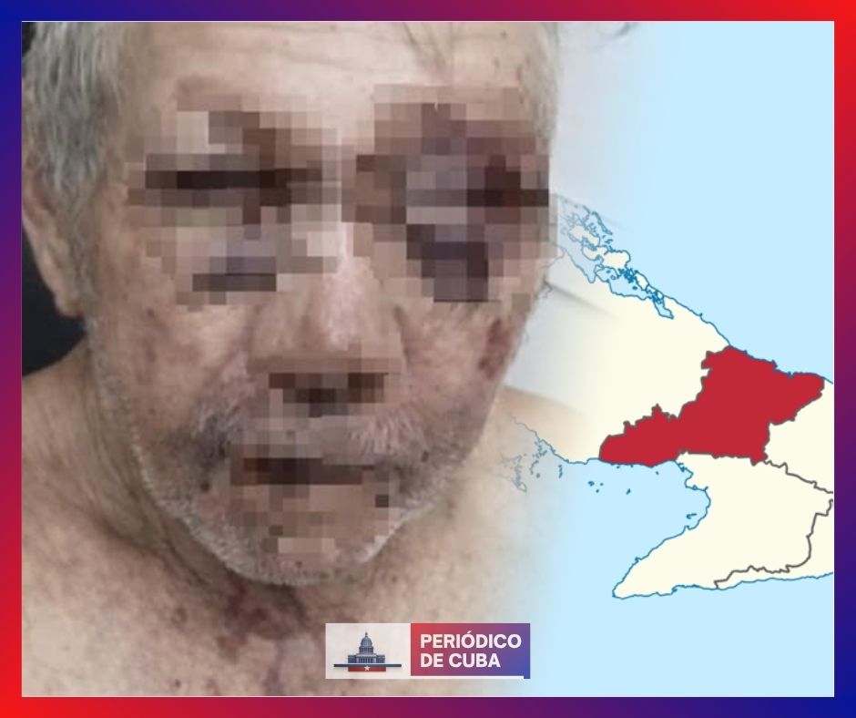Campesino golpeado en Las Tunas expone creciente violencia y robo de ganado