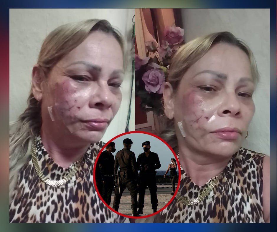 Denuncian golpiza a mujer tras ser detenida por gritar “libertad” en Cuba