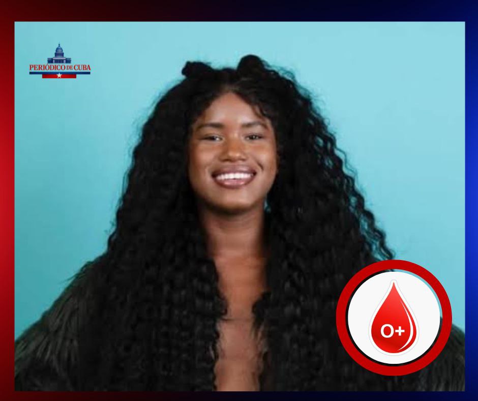 Influencer cubana Yurisleydis Mora “RiRi” en estado crítico tras sufrir quemaduras graves