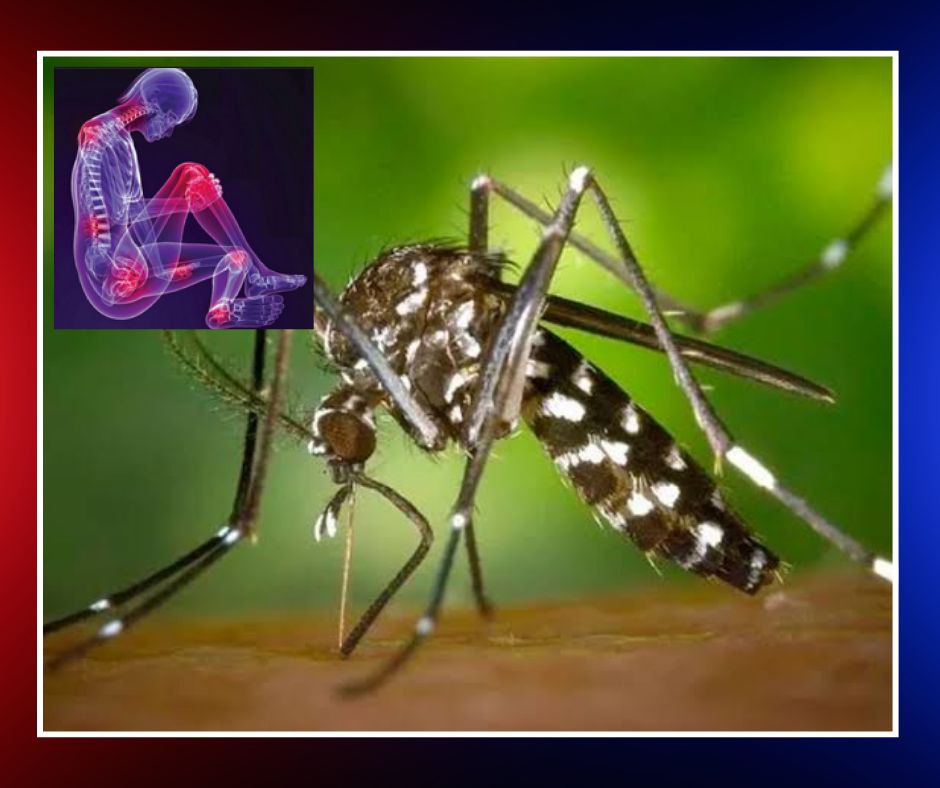 Chikungunya en Cuba: las secuelas crónicas que preocupan a pacientes y médicos