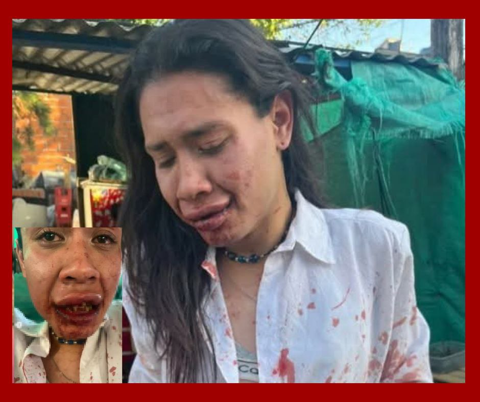 Brutal ataque transfóbico contra activista trans en Tigre desata alarma por violencia en Argentina