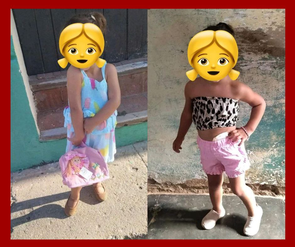 Niña cubana con colostomía necesita ayuda urgente para acceder a bolsas médicas