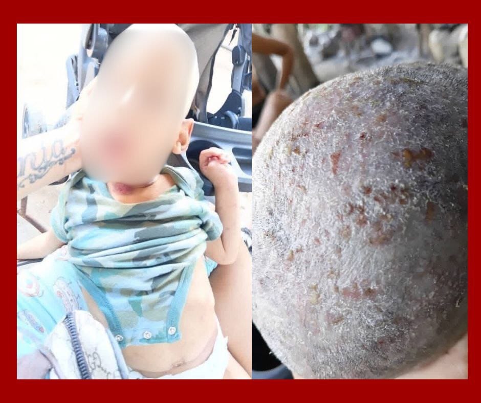 Niño enfermo sin atención médica en Ciego de Ávila genera alarma