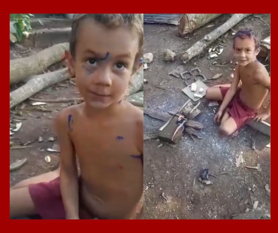 El Hambre en Cuba tiene Rostro: Niño de 9 Años Asa Plátano en una Hoguera Improvida en Guisa, Granma